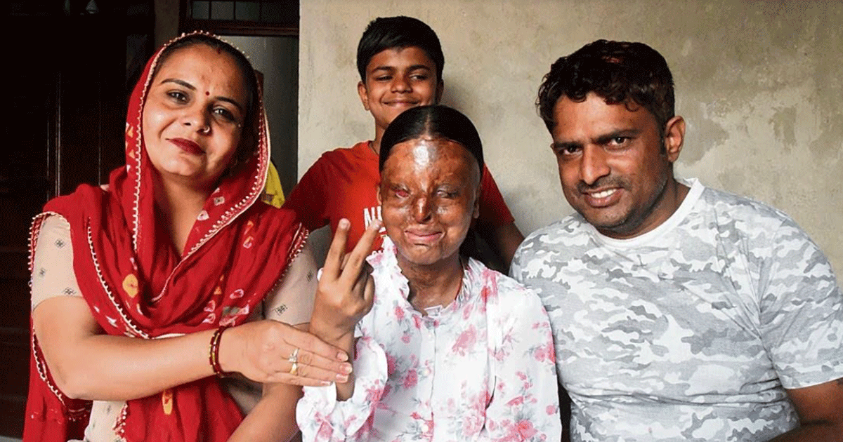 Kafi Becomes a Symbol of Courage: Acid Attack Survivor Tops Class 12 with 95.6% Marks