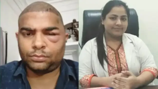 Big Revelation in Kanpur Hair Transplant Case: Dentist Performed Surgery for ₹40,000, Two Youths Dead